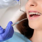 How A Choose The Right Orthodontist For You