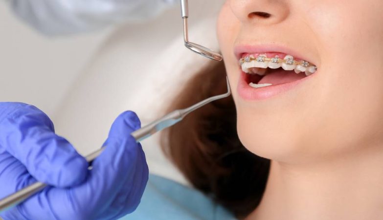 How A Choose The Right Orthodontist For You