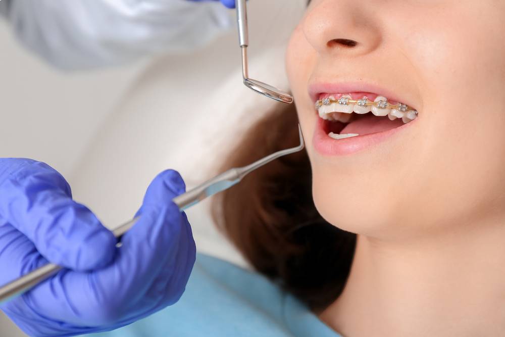 How A Choose The Right Orthodontist For You